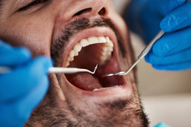 Best Broken or Cracked Tooth Emergency Dentist in North Pole, AK
